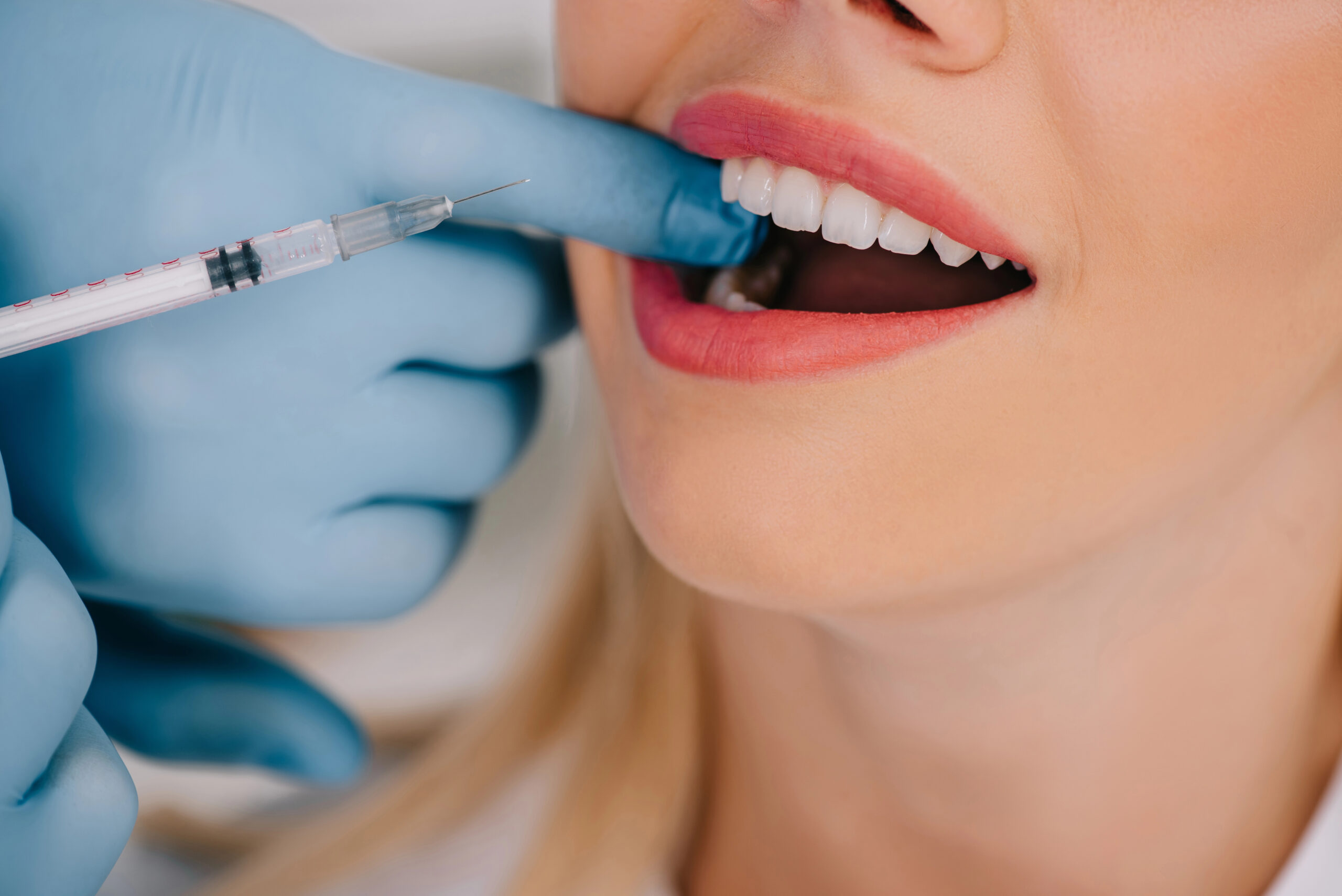 A close-up of a dentist administering a local anesthetic injection to a patient, illustrating what anesthesia is used for wisdom teeth removal to ensure a comfortable and pain-free experience.