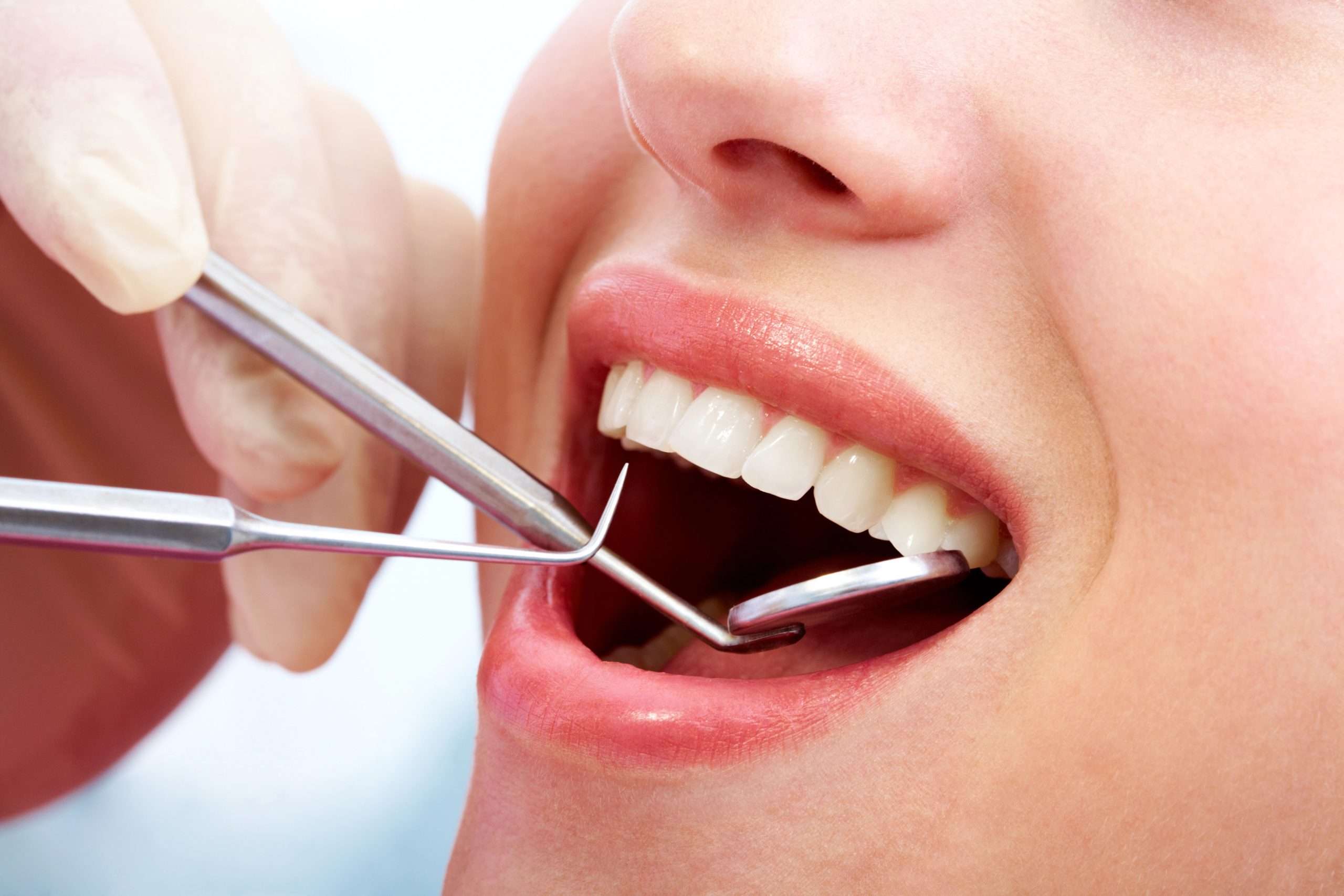 Miami Dental Fillings | Dr. Patty Miami Cosmetic Dentistry